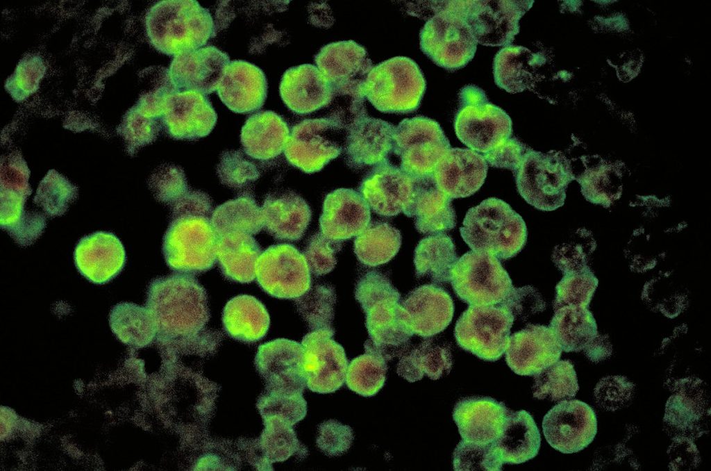 As Investigation Continues Into Ameba Infection, The DHSS Offers Tips To Stay Safe